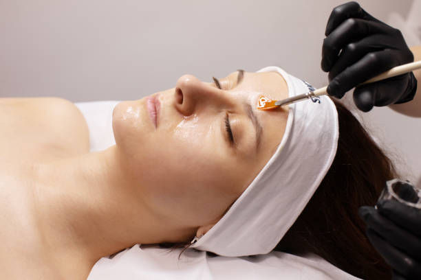 Can Inno Peel Improve Skin Texture and Smoothness