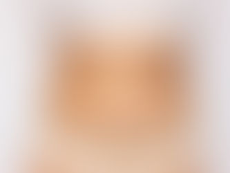 How Can Liposuction Shape Your Body Faster