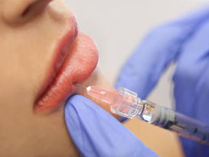 What Are the Benefits of Lip Fillers Injection Treatments
