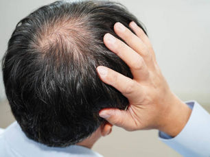 Can GFC Treatment for Hair Strengthen Weak Hair Roots