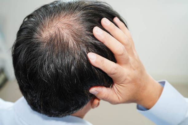 Can GFC Treatment for Hair Strengthen Weak Hair Roots
