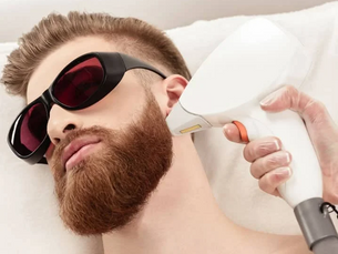 How beard laser hair removal feels on skin