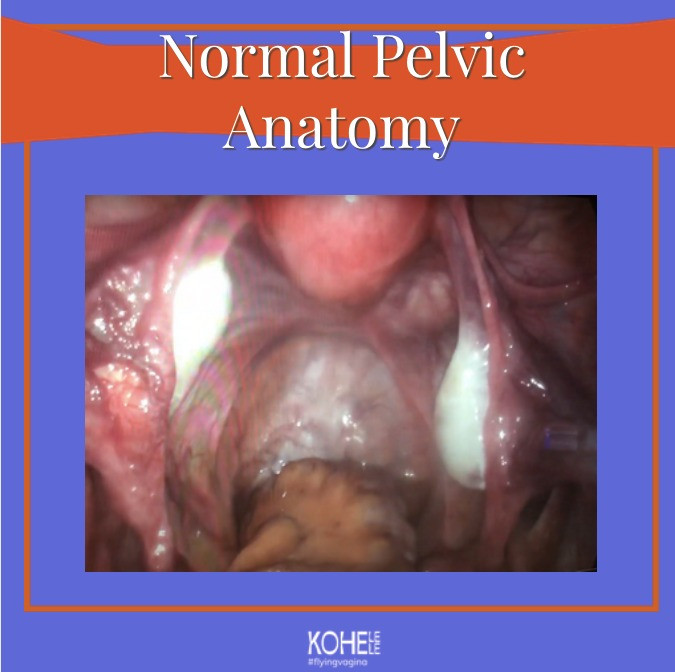 Normal Pelvic Anatomy