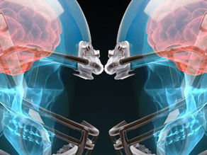 Traumatic Brain Injury (TBI) From Playing Sports?