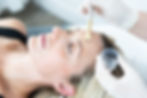 Client receiving a chemical peel at O Esthetics, with skincare professional applying treatment in a clinical setting