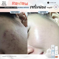 LINE_ALBUM_BEFORE _ AFTER_211130_2.jpg