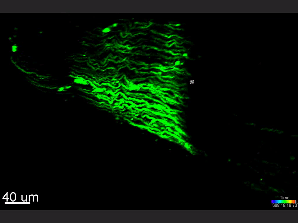 3d nerve segmented-gif.gif