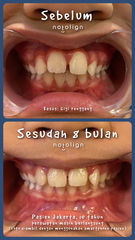 Denz 8 bulan (1).jpg