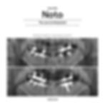 Noto Case 003