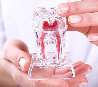 tratamento de canal, remoção de dente, cuidado com a boca, dentista