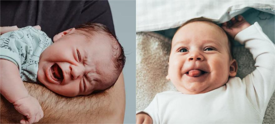 Baby Tongue-tie revision white birch dental