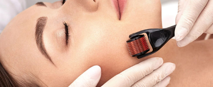 derma roller_edited.jpg