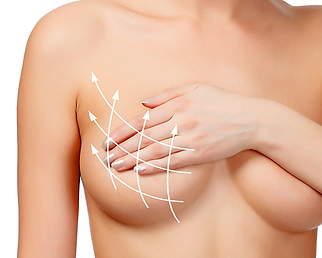 breast lift.png