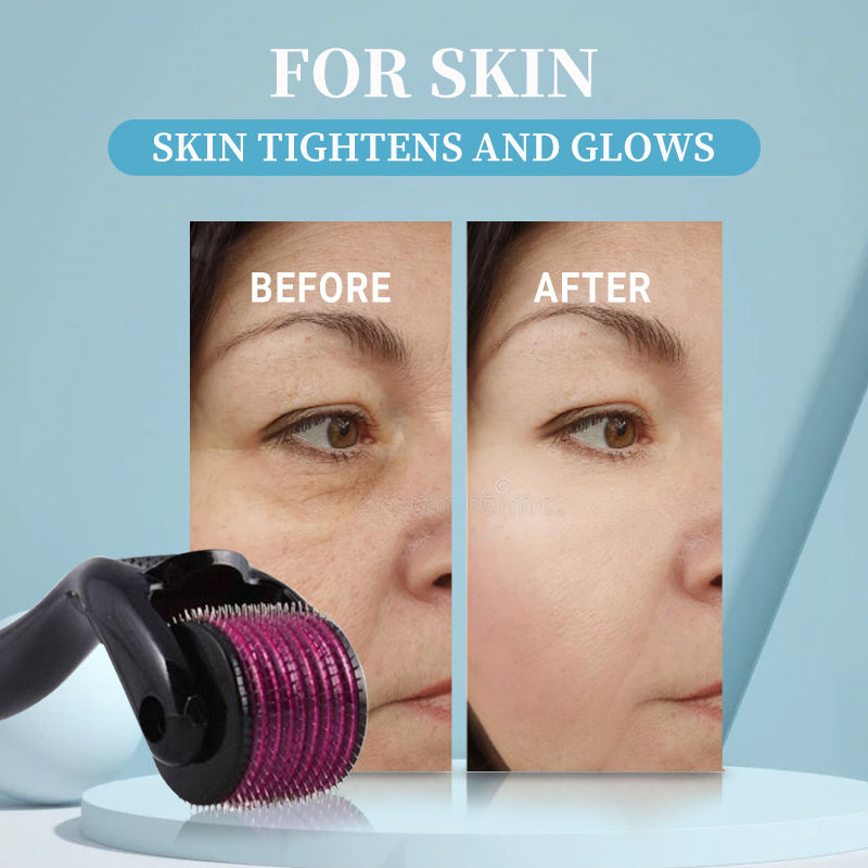 Thumbnail: Micro Needling 540 Roller Derma Roller Professional Titanium Dermaroller 0.2/0.2