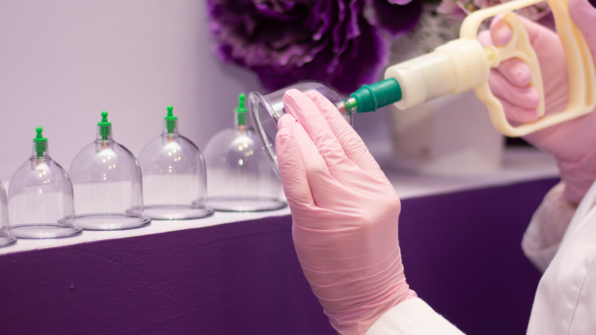 HijamaWorldUK cupping