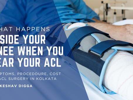 What Happens Inside Your Knee When You Tear Your ACL
