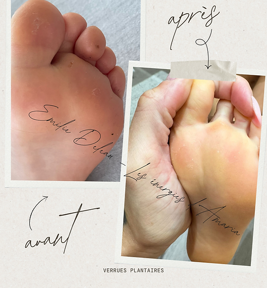 avant-après emilie Deleau magnétiseuse Bourgbarré rennes bretagne