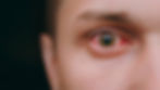 ree