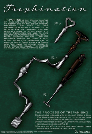 the process of trepanning is shown on a green background