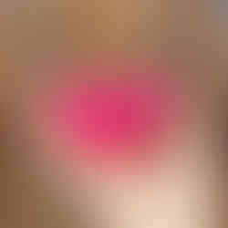 Ziggy Cup 2 サイズBの写真