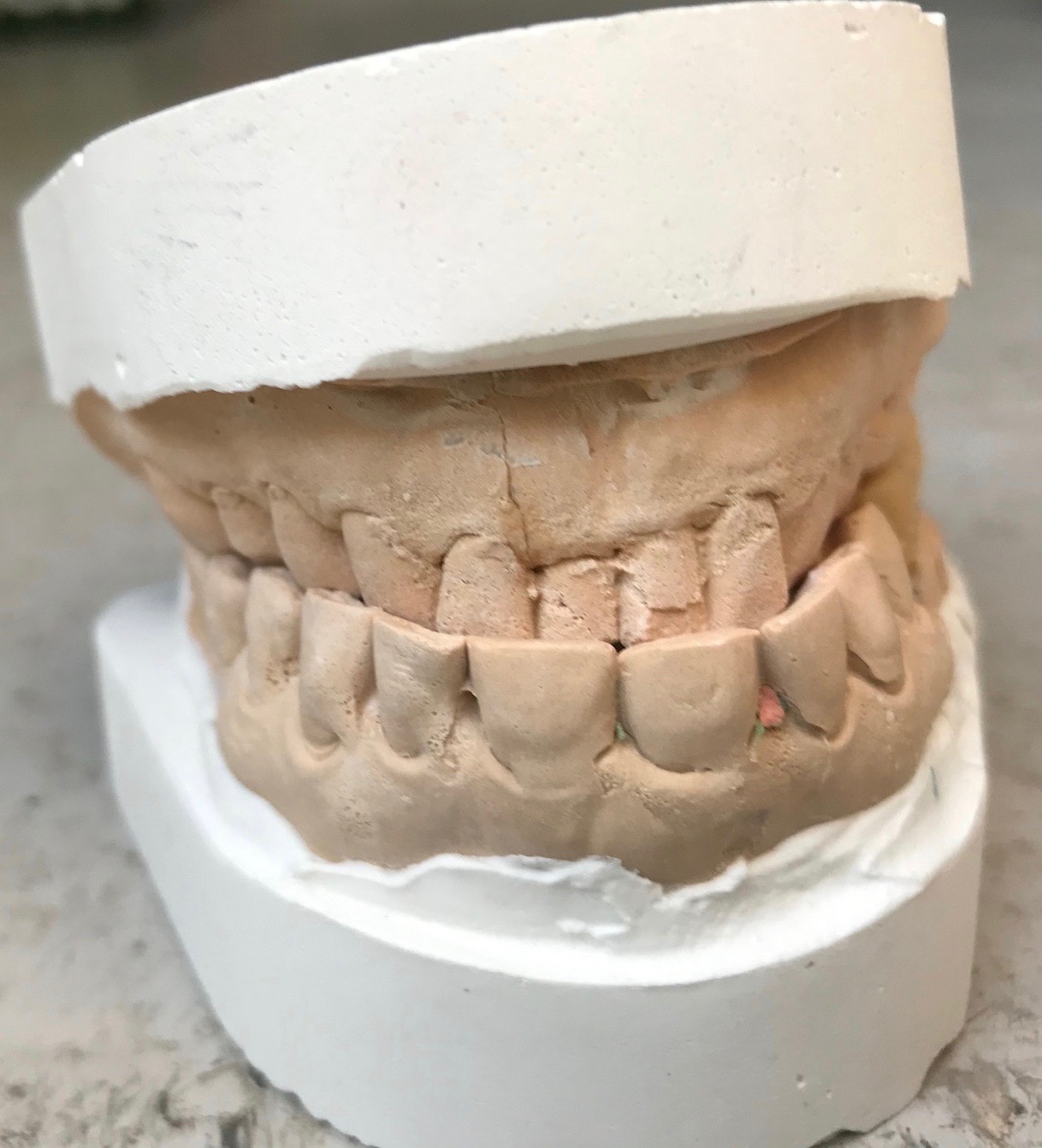 Outils du dentiste