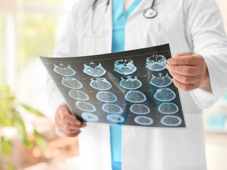 Neurologové chomutovské nemocnice prezentovali odborné výsledky