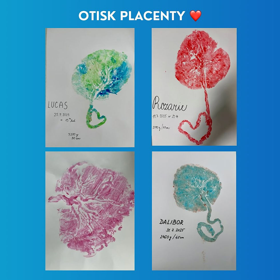Otisk placenty jako strom života z Porodnice Most.