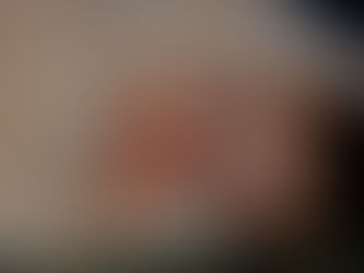 風邪のようなアレルギーのような症状