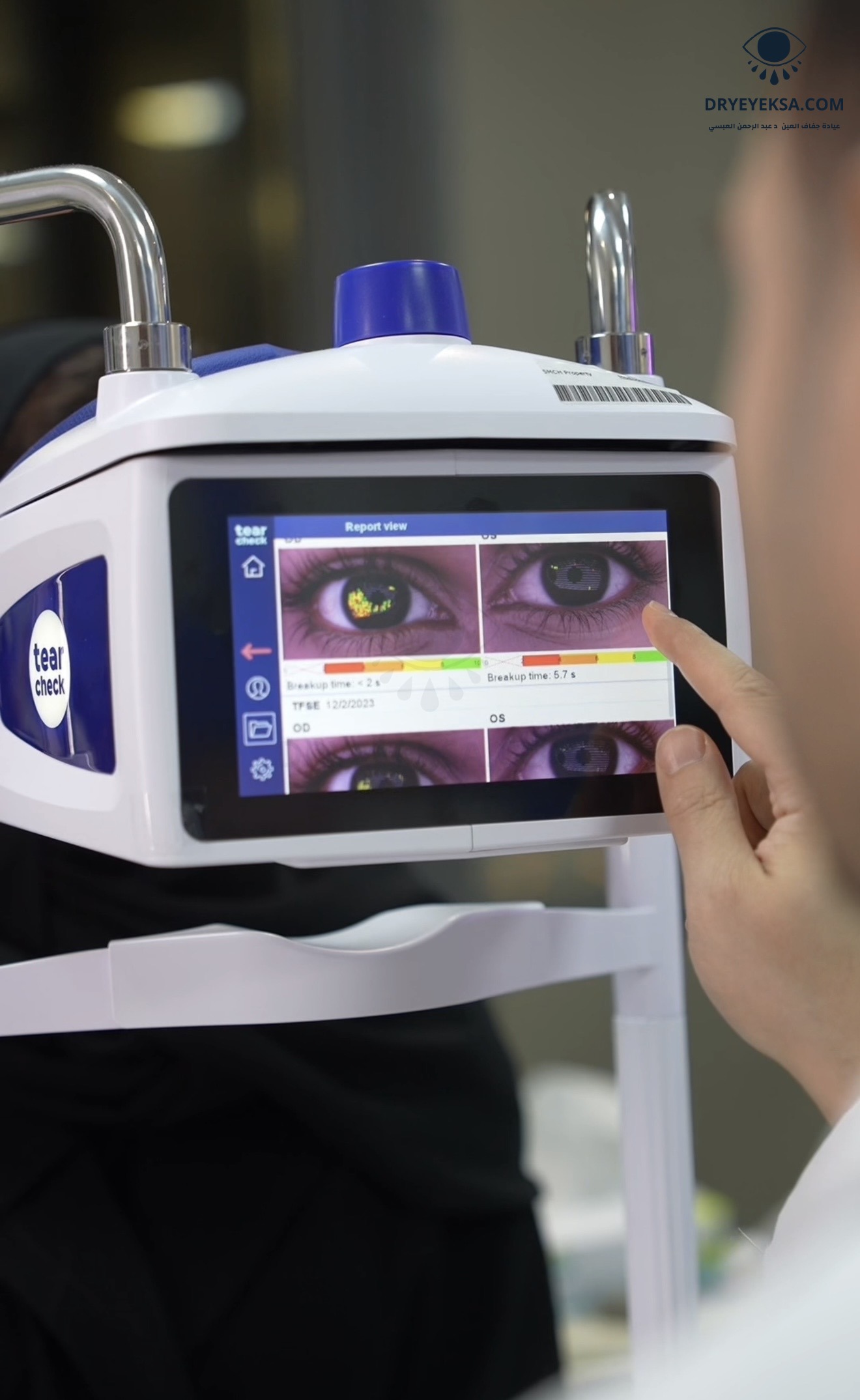 TearCheck dry eye analyzer – the doctor reviewing a tear analysis report on the tablet