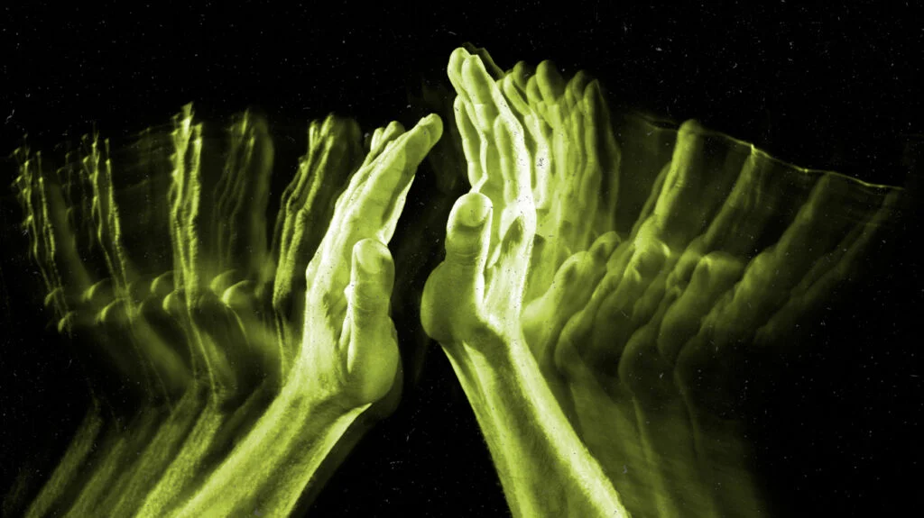 alien hand syndrome