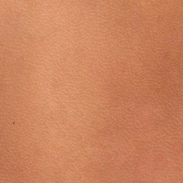 human-bumpy-skin-1-crop.jpg05bd39bc-3183-4a71-951b-6f3c77c54452Large