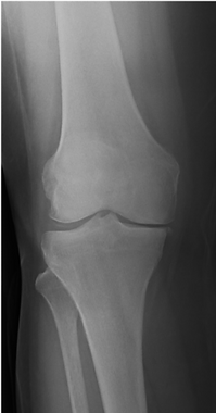 Radiografia.png