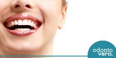 Fatos sobre clareamento dental