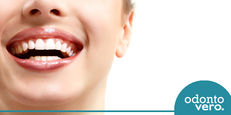 Fatos sobre clareamento dental