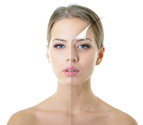 BOTOX