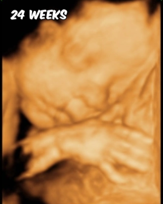 Resting on moms placenta