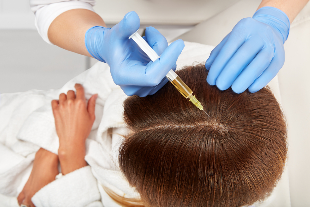 PRP injections for hair treatment imagery