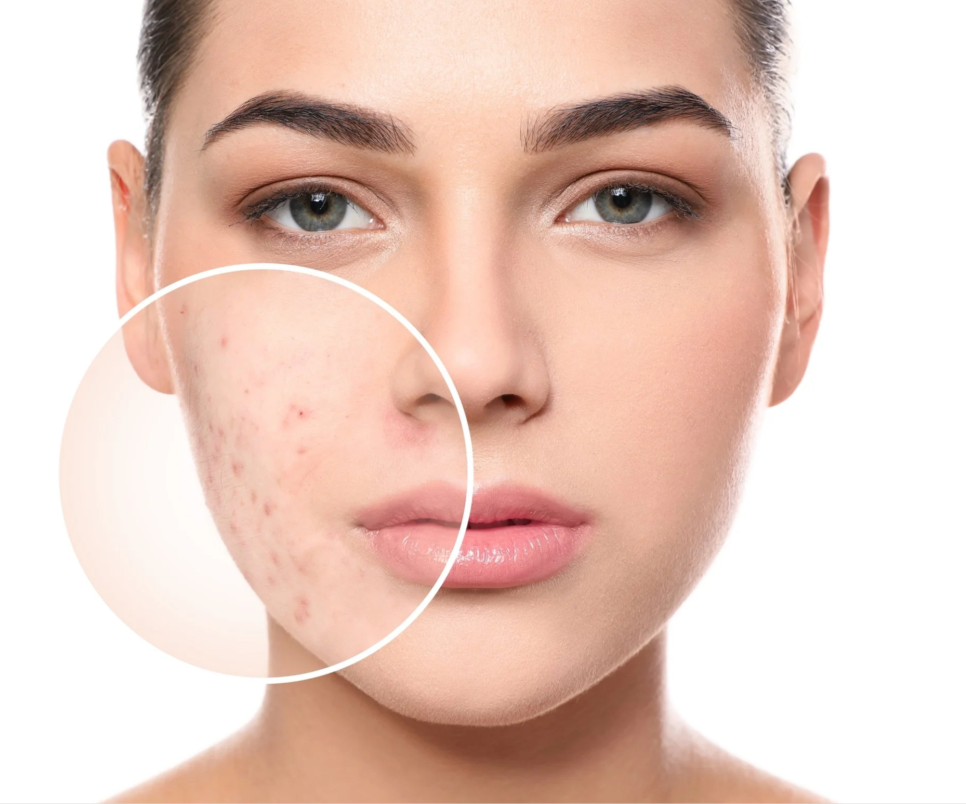 Clear Skin facial treatment imagery