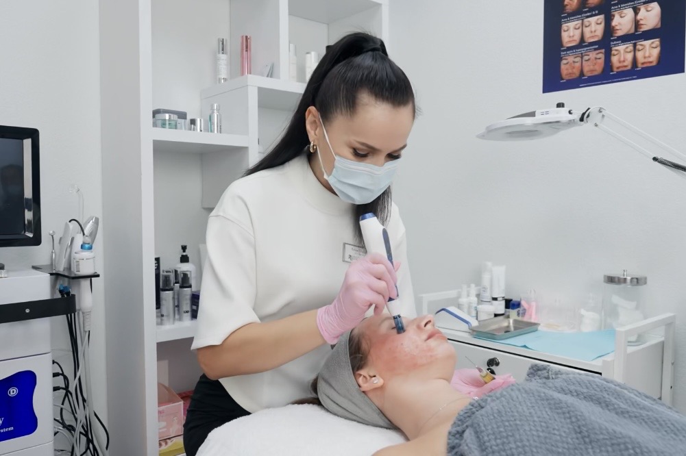 Microneedling treatment at Radiant Refine Spa