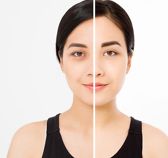 Closeup before after asian woman face. Before-after cosmetic procedures. Skin care wrinkle