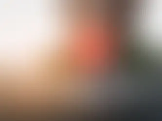 Joints Specialist Doctor in Delhi: The Ultimate Guide to Knee, Hip & Joint Pain Treatment