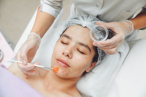 cosmetologist-does-facial-care-apply-face-mask-cleansing-heavily-soiled-face-acne-skin-ski