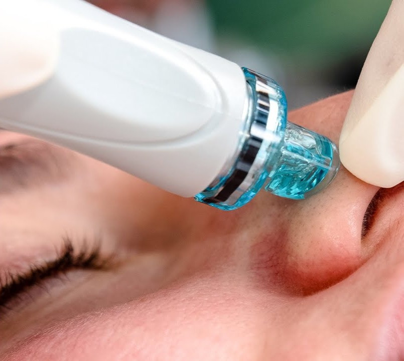Hydra Facial Durban | Emporium Beauty SA