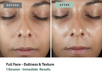 Diamond Glow - Oviedo, FL - Before and After - Dullness.jpg