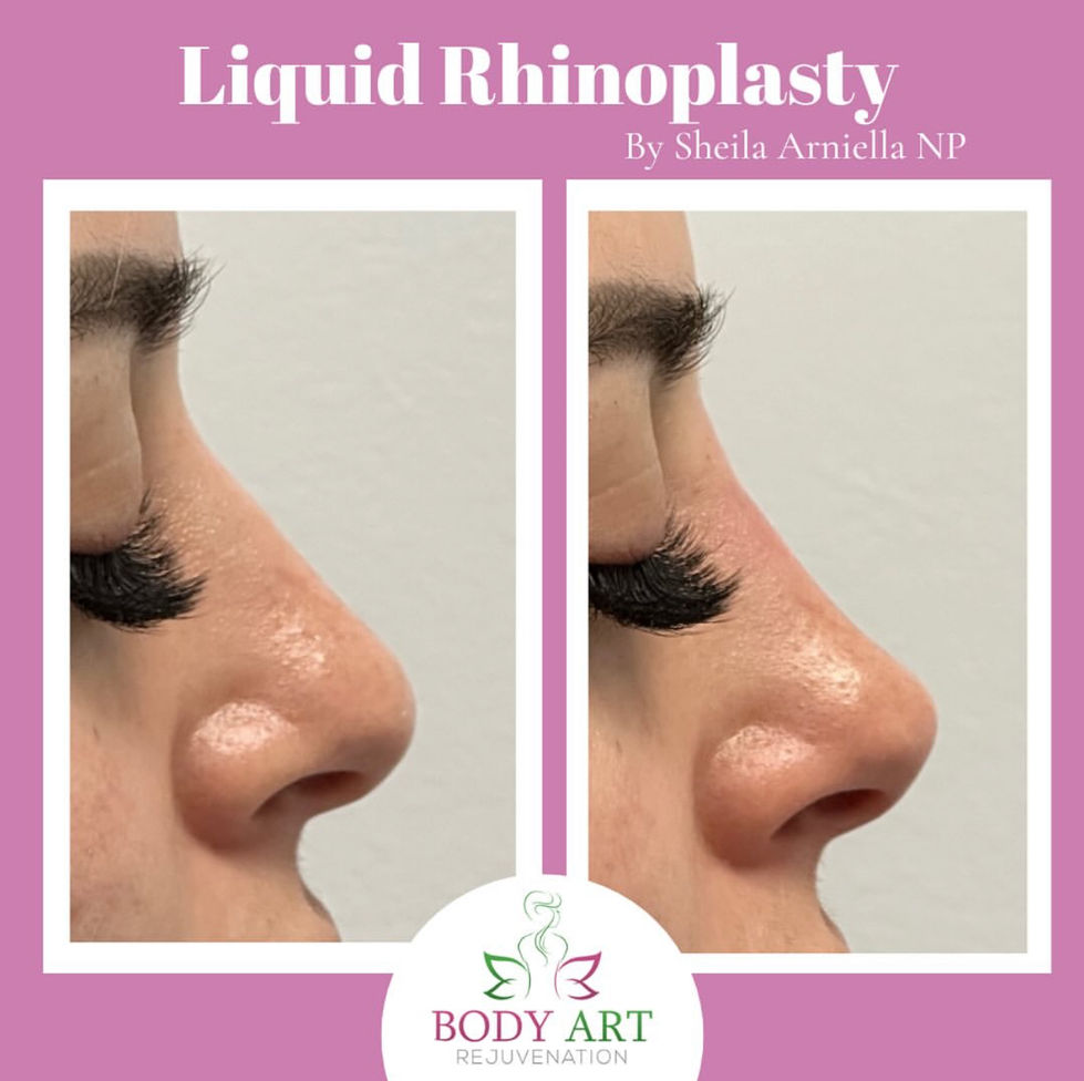 Non-surgical solution to enhance your profile!
