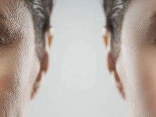 Why One Treatment Is Rarely the Answer to Facial Rejuvenation
