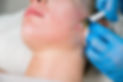 woman getting injected with PRF treatment on the face to enhance and rejuvenate the skin
