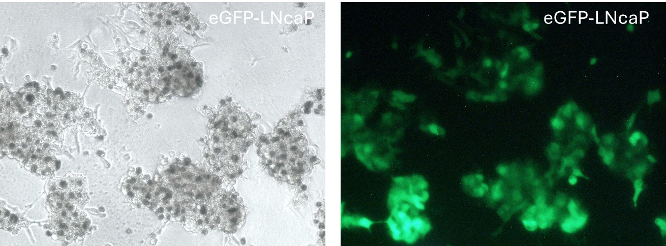eGFP LNCaP stable cell line