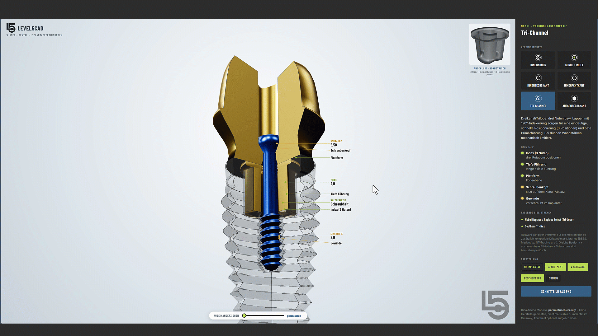 L5CAD_Implantatantypen_V2.gif