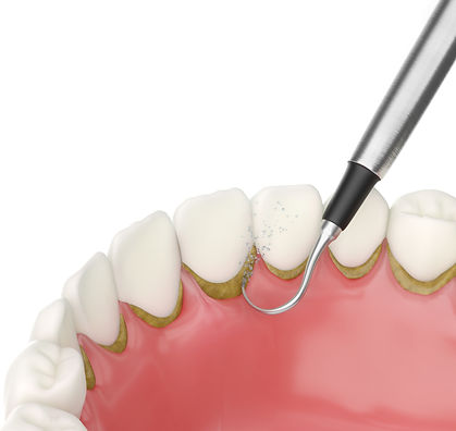 outine dental check-up at Luxe Dental Clinic.